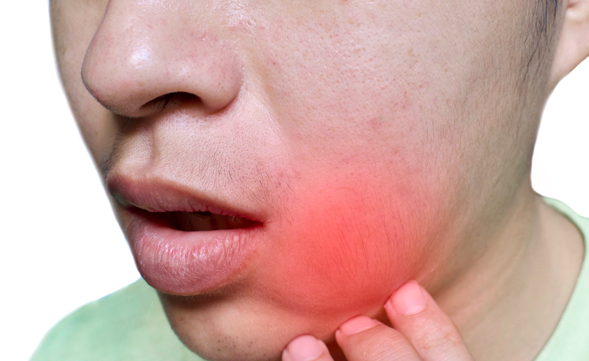 Patient with jaw swelling and dental inflammation